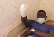 Mbacké: la main d’un « jakartaman » amputée suite à une agression