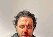 LIGUE 1 : Le match qui devait opposé l’Olympique de Marseille à l’Olympique Lyonnais a été annulé, Grosso évacuer à l’hôpital